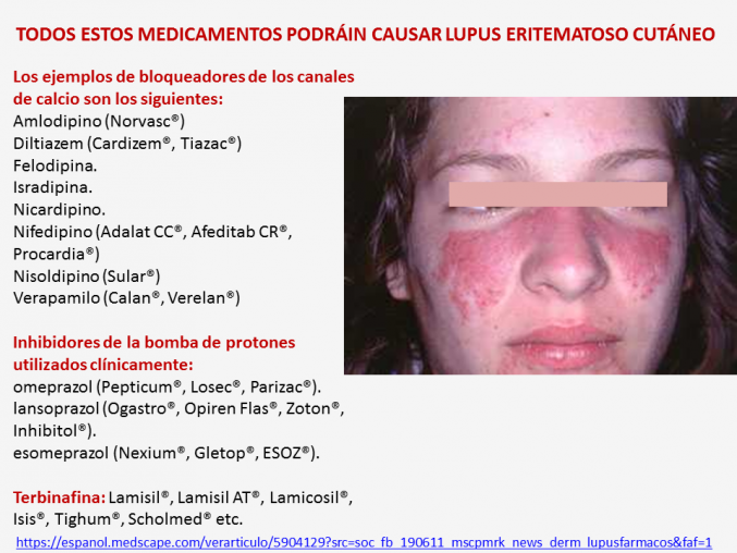 ¿Lupus eritematoso cutáneo? Quitar fármacos puede ser mejor que indicarlos.