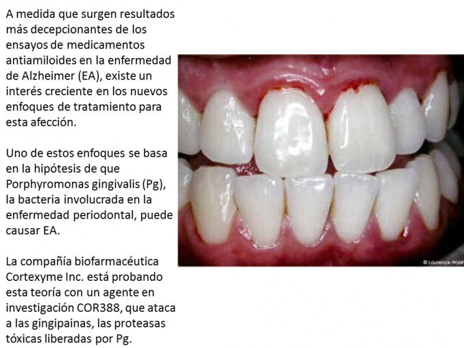 Hipotesis novedosa sobre el origen del Alzheimer