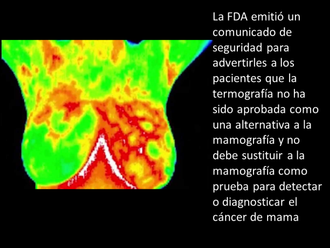 La FDA advierte sobre la termografía