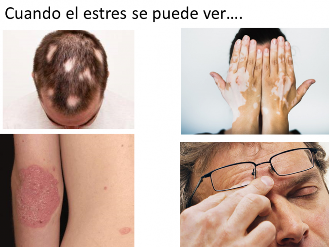 Algunos efectos del estrés...
