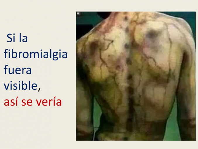 Una de las mas incomprendidas enfermedades.