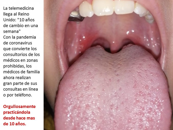 Atención médica a distancia, eso es telemedicina