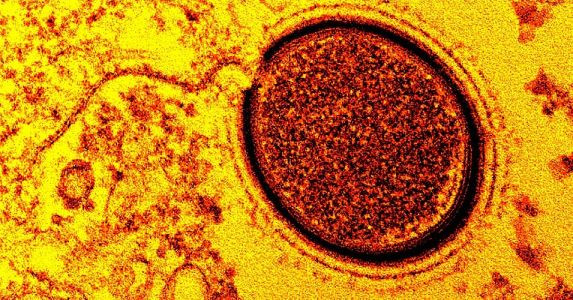 Los virus prehistoricos y el calentamiento global