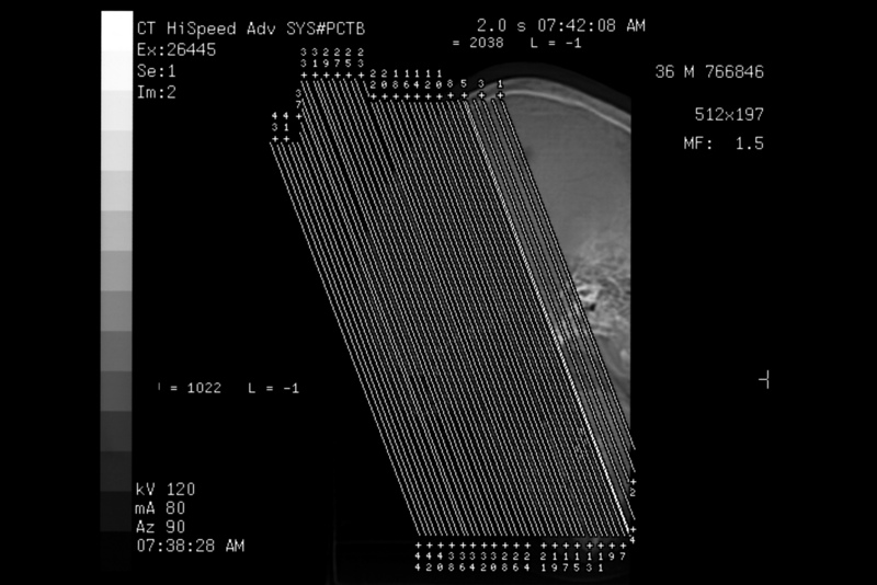 ADVERTENCIA: Realizar el ultrasonido en el embarazo, es riesgoso para las bebés
